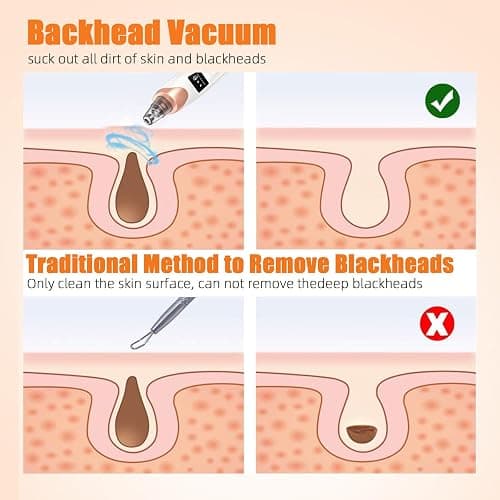 2025 Pore Vacuum, USB Rechargeable Blackhead Remover Vacuum,3 Levels Adjustable Pore Vacuum Blackhead Remover, with 5 Suction Power,6 Probes,Face Vacuum Pore Cleanser for Women & Men-White thumbnail 6