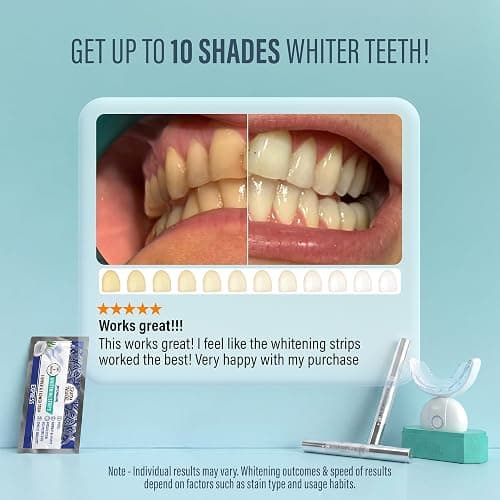 GuruNanda Teeth Whitening Kit, Up to 10 Shades Whitening, 40 Treatments | Wireless Led Accelerator Teeth Whitener|Comes with 8% Hydrogen Peroxide Teeth Whitening Gel Pen & Teeth Whitening Strips thumbnail 3