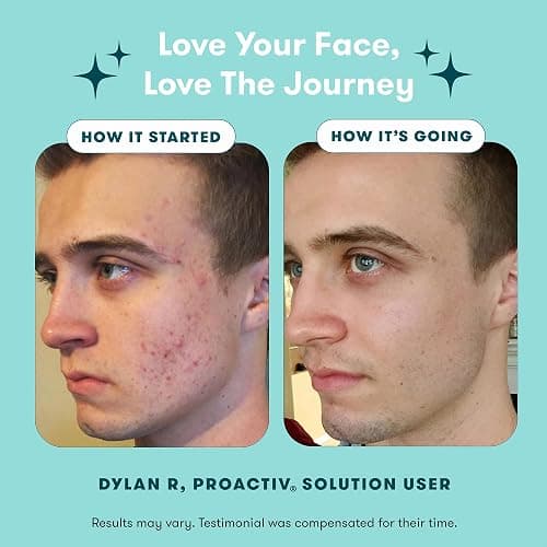 Proactiv 3 Step Acne Treatment - Benzoyl Peroxide Face Wash, Repairing Acne Spot Treatment for Face and Body, Exfoliating Toner - 30 Day Complete Acne Skin Care Kit thumbnail 6