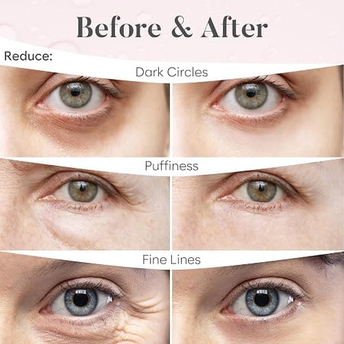 BLOOMORA Rose Under Eye Patches (30 Pairs) - Under Eye Mask for Appearance of Dark Circles - For Puffy Eyes Smoothing - Skincare Mask thumbnail 4
