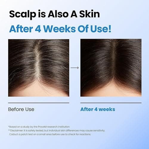 Seapuri Scalpy Hair Growth Serum for Men & Women for Hair Loss & Thinning | Scalp Treatment with Salicylic Acid, Menthol, Dexpanthenol | Non-Greasy, Lightweight | Exfoliates Dandruff & Soothes Itch thumbnail 6