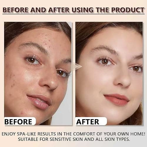2PCS Rice Exfoliating Ampoule Set, Black & White Rice Peel Shot Glow Rice Ampoule Duo, Gentle Peel + Pore Minimizing & Deep Hydration for All Skin Types thumbnail 4
