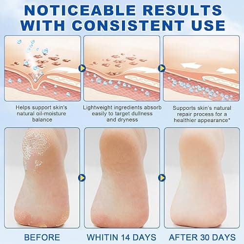 60% Urea Cream Stick plus 2% Salicylic Acid, Maximum Strength Urea Foot Cream Callus Remover for Dry Cracked Heels, Hands, Knees,Exfoliating Moisturizer, Dead Skin Remover Foot Balm 1.4oz (1pcs) thumbnail 4