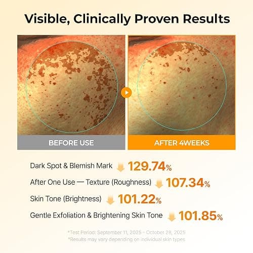 Dr.Melaxin TX Kojic Acid Turmeric Toner Pads with Tranexamic Acid, Brightening Toner Pad for Pigmentation & Dark Spot Care, Gentle Keratin Care for Radiant Skin, Korean Skincare, 70 Sheets thumbnail 3