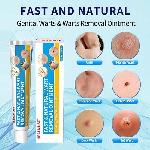 HEALMUSZ Wart Remover Contains 17% Salicylic Acid Skin Tag Remove Fast-Acting Natural Wart Removal Cream for Common Warts Plantar Warts Hand and Other Body Warts thumbnail 2