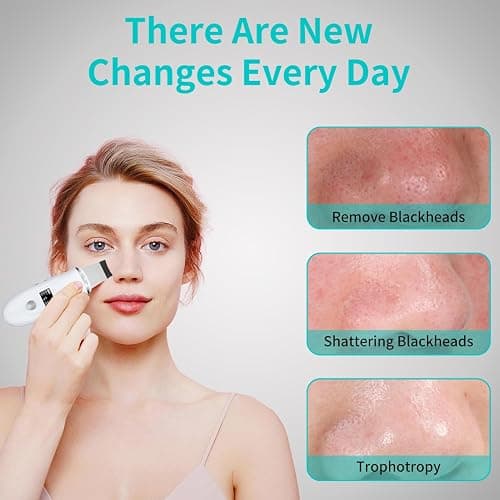 Face Scrubber Skin Spatula - Blackhead Remover Deep Cleansing Tool for Pore Extraction, 4-in-1 Fast Charging Dock Blackhead Remover Face Spatula for Facial Skincare Women Gift (White) thumbnail 6