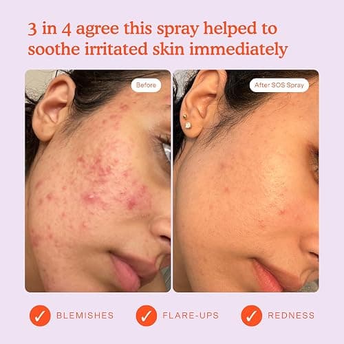 Tower 28 SOS Daily Rescue Facial Spray - Hypochlorous Acid Spray to Help Reduce Redness, Calm Irritation + Alleviate Flare-Ups - Soothing + Purifying Face Toner - Everyday Skin Care Essential (4 oz) thumbnail 4