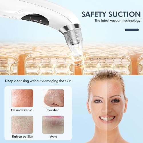 CHIMOCEE Blackhead Remover Pore Vacuum, Upgraded Black Head Remover for Face, Electric Acne Comedone Whitehead Extractor Tools-5 Suction Power, 5 Probes, USB Rechargeable Pimple Popper Tool Kit thumbnail 5