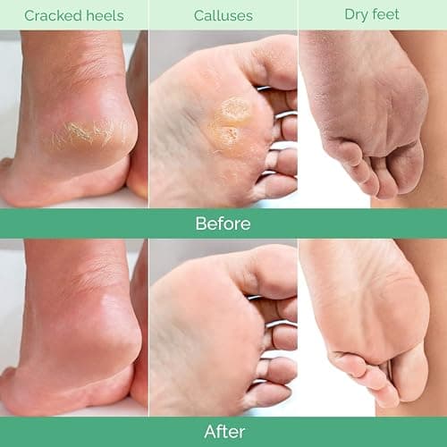 PLANTIFIQUE Foot Peeling Mask 2 Pack | Dermatologically Tested Repairs Heels & Removes Dry Dead Skin for Baby Soft Feet | Exfoliating Foot Peel Mask for Dry Cracked Feet | Peach thumbnail 3