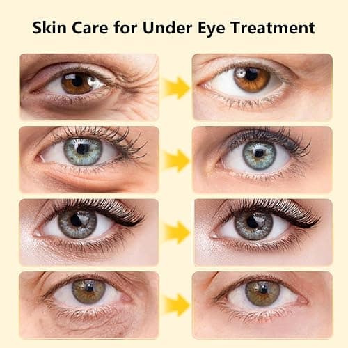 Adofect Under Eye Patches 30 Pairs, 24K Gold Under Eye Mask with Hyaluronic Acid for Dark Circles and Puffy Eyes, Bachelorette Party Accessories, Bridesmaid Gifts, Daily Skin Care thumbnail 3