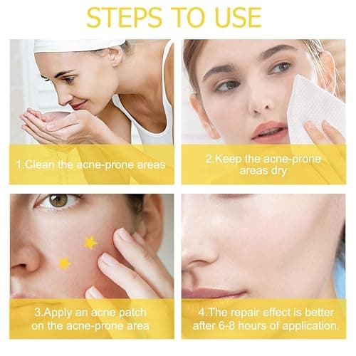 AWAVM 40 Parches de Acné Hidrocoloide, Parches de Acné en Forma de Estrella, Parches Acne, Pimple Patches Facial, con Caja de Espejo Portátil thumbnail 6