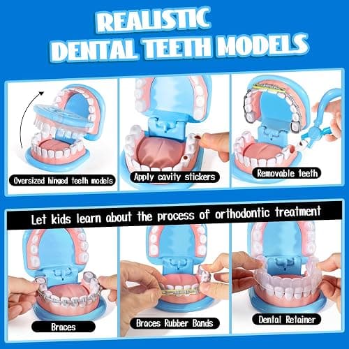 Dentist Playset for Boys with Oversized Pretend Teeth /Removable Teeth /Braces /Retainer - Kids Doctors Play Set - Teeth Model for Teaching - Role Play Toys for Kids 4-6 (Blue) thumbnail 3