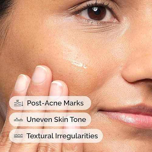 The Ordinary Aloe 2% + NAG 2% Solution, Soothes Skin and Targets Post-Acne Marks, 30ml thumbnail 4
