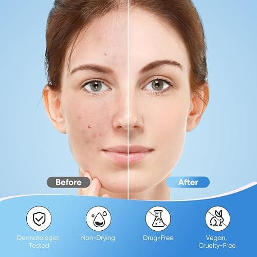 QUSTERE Pimple Patches for Face, Hydrocolloid Acne Patches, Sparkling Star Zit Covers, Colorful Spot Stickers with Tea Tree, Salicylic Acid & Cica Oil| 3 Sizes (10mm, 12mm & 14mm) |240 Count thumbnail 5