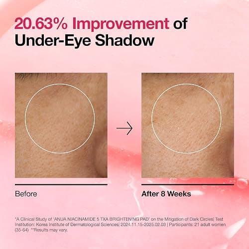Anua Niacinamide 5 TXA Toner Pads – Hydrating Facial Pad for Even-Looking Skin Tone & Daily Radiance Care, Glow up Under-Eye with Tranexamic Acid, Korean Skin Care (210ml, 60 Pads) thumbnail 6