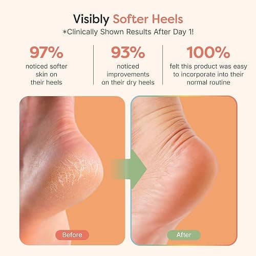 ZenToes Moisturizing Socks for Cracked Heel Treatment, Vitamin E, Olive Oil and Jojoba Oil Infused Heel Socks, Galentines Day Gifts, Self Care Gifts for Women (Fuzzy Pink, Regular) thumbnail 3