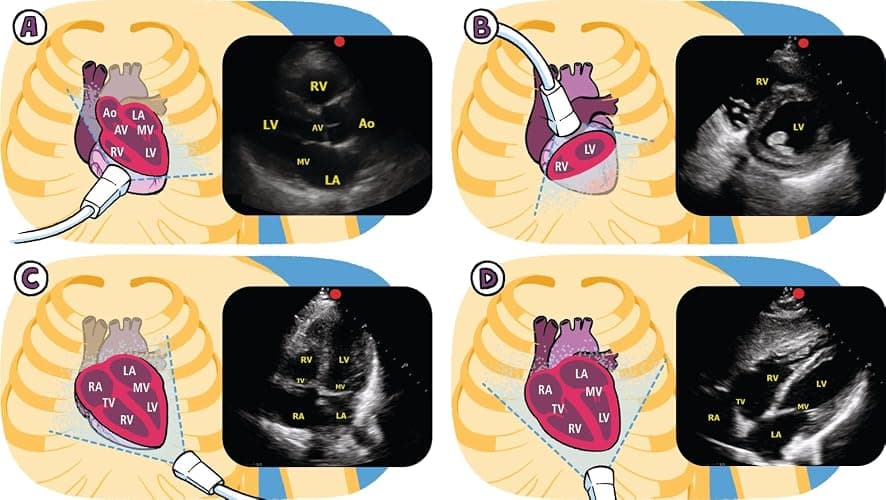 Critical Care and Hospitalist Medicine Made Ridiculously Simple thumbnail 2