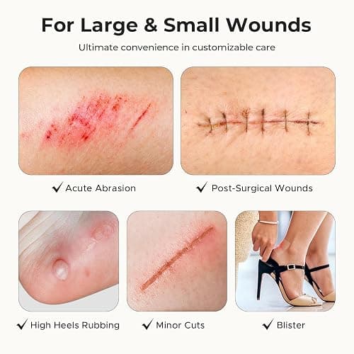 TKTK Hydrocolloid Roll 2 Sizes, Cut-to-Fit Bandages for Pimple & Wounds | 2in x 5ft + 1in x 5ft Pimple Patch Roll Value Pack, Long-Lasting, for Acne & Wounds, Easy-Peel, Waterproof, No Additives thumbnail 5