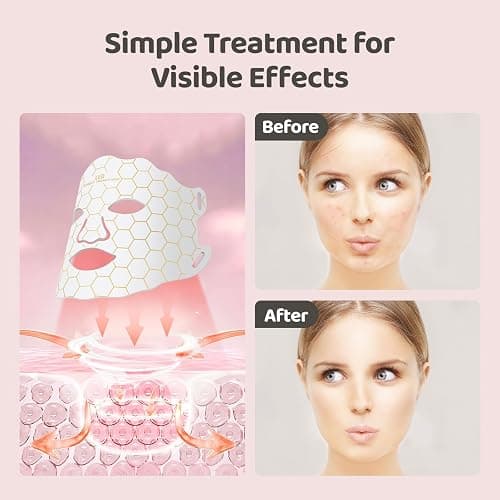 light therapy mask thumbnail 4