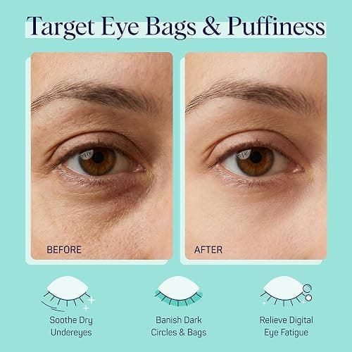 SpaLife Cooling Cucumber Eye Pads | Spa Gifts & Korean Dark Circles & Puffy Eyes Treatment | Nourishing Cucumber Eye Pads | Eye Mask for Puffy Eyes Daily Depuffing Eye Patches | 4 Packs of 12 thumbnail 2