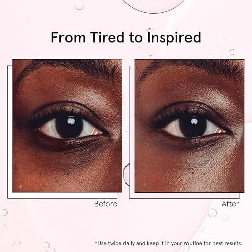 grace & stella Under Eye Brightener with Cooling Metal Rollerball - Ceramide & Caffeine Eye Cream for Puffy Eyes - Travel Size Toiletries - Vegan Skincare (15ml / 0.51floz) thumbnail 5