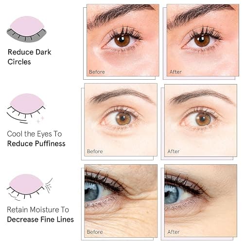 grace & stella Under Eye Gel Patches Multi-Color Pack - 4 Pairs of Under Eye Patches for Dark Circles - 4 Colors/1 Pair Each - Puffy Eyes Treatment - Vegan Cruelty Free Birthday Gifts for Women thumbnail 8