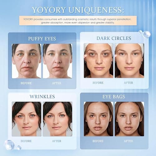 YOYORY Under Eye Patches Masks - for Dark Circles, Puffy Eyes, Fine Lines, Wrinkles, Eye Bags Treatment with Collagen and Hyaluronic Acid,Firming & Cooling, Moisturizing and Hydrating (60 Pcs) Blue thumbnail 2