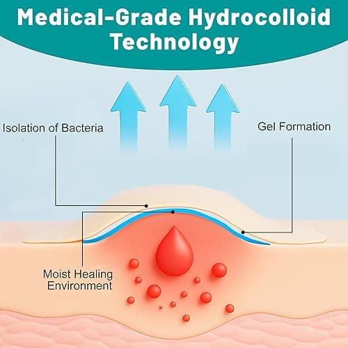 Hydrocolloid Roll, Hydrocolloid Bandages Roll for Wound Care, Medical Grade, Cut-to-Size, Self-Adhesive, Flexible & Waterproof, First Aid Kit Essential (2in x 6ft, 0.3mm Thickness) thumbnail 5