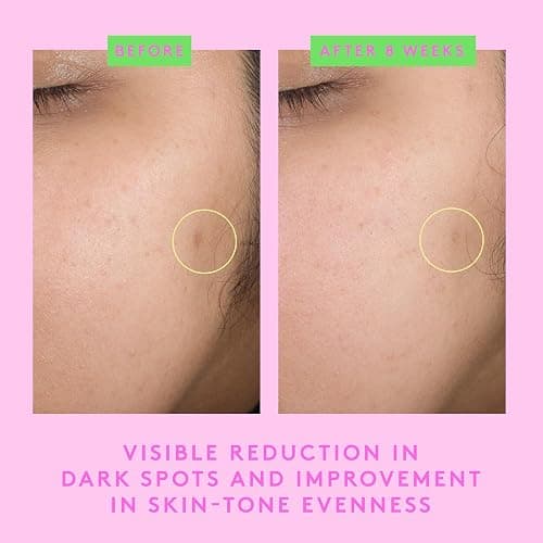 Drunk Elephant B-Goldi Bright Drops - 30 ml/1 fl oz - Illuminating Color Serum Drops - Clean Clinical Skincare - Cruelty-Free - Dermatologist-Tested - Free of Essential Oils, Silicones, and Fragrance thumbnail 6
