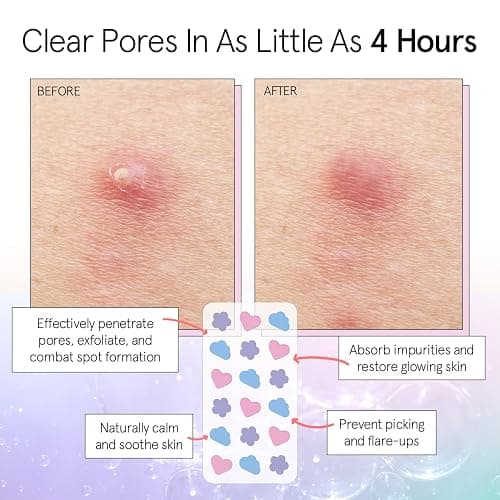 grace & stella Award Winning Pore Strip - Pimple Patches for Face - Hydrocolloid Acne Patches - Absorbs Zits, Reduces Redness - Cute Patches Dermatologist-Tested, Vegan (Multishape, 36 Count) thumbnail 3