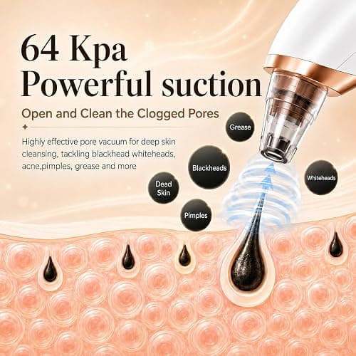 Blackhead Remover Vacuum for Face, 3 Adjustable Suction Levels, White | Adjustable Pore Cleaning, 5 Interchangeable Probes, USB Rechargeable Design thumbnail 2