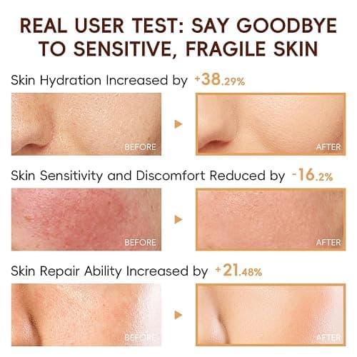 Rice Skincare Set for Teen Girl Gifts Birthday - Skin Care for Teens 10-12 - Hydrating Skin Care Routine Kit for Women - Gifts Birthday Facial Kit for Women - Skin Care Set with Cleanser,Serum thumbnail 6