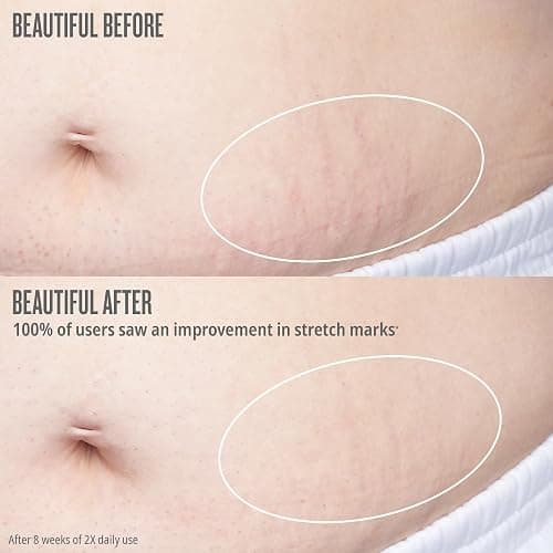 Sol de Janeiro Bum Bum Firmeza Body Oil - Stretch Mark Oil thumbnail 6