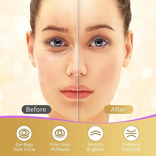 USTELIR Under Eye Patches, 40 Pairs Eye Mask for Dark Circles, Puffy Eyes, Undereye Bags,Wrinkles,Eye Mask Patches with 24K Gold, Eye Treatment Skin Care for Men & Women Gift thumbnail 4