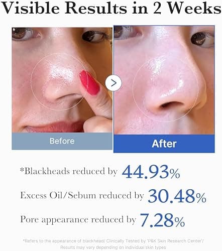 Medicube Zero Pore Pads 2.0 - Dual-Textured Facial Toner Pads for Exfoliation and Minimizing Pores with 4.5% AHA Lactic Acid & 0.45% BHA Salicylic Acid - Ideal for All Skin Types - Korean Skin Care thumbnail 5