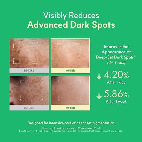 Easydew DW-EGF Melatoning Ampoule 5X - Hydrating Dark Spot Serum with Niacinamide & Glutathione for Uneven Skin - Fast Absorbing Day & Night Ampoule Korean Skin Care (Pump 0.27 fl oz, EGF 5X) thumbnail 3