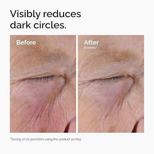 The Ordinary Caffeine Solution 5% + EGCG Eye Serum, Depuffing Eye Serum for Dark Circles and Tired Eyes thumbnail 5