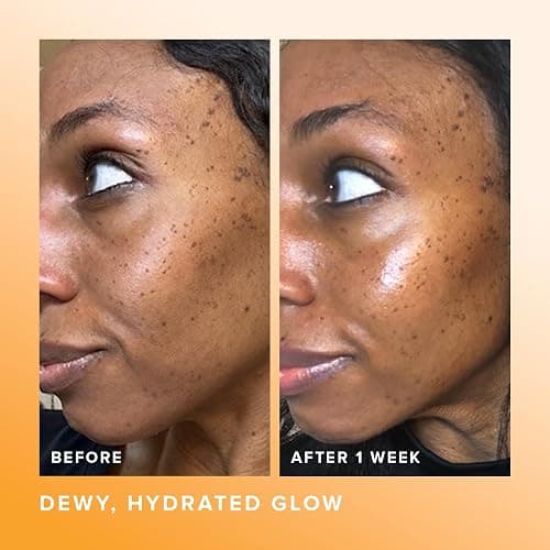Farmacy Hydrating Essence - Hydrating Honey Milk Toner + Facial Essence to Soothe, Moisturize and Strengthen Skin Barrier - Preps Complexion for Skincare Products or Makeup Application (10ml) thumbnail 4