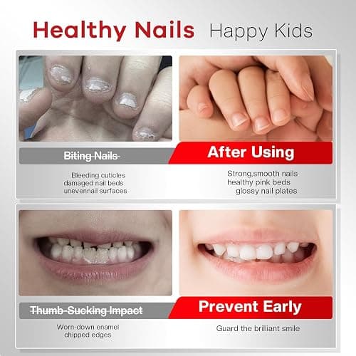 Glamonade Nail Biting Prevention Kids Extra Bitter Thumb Sucking Deterrent | 48H Long-Lasting Matte Repairs Damaged Nails Safe Habit Breaker for Nail Biting Thumb Sucking Kids Adults thumbnail 4