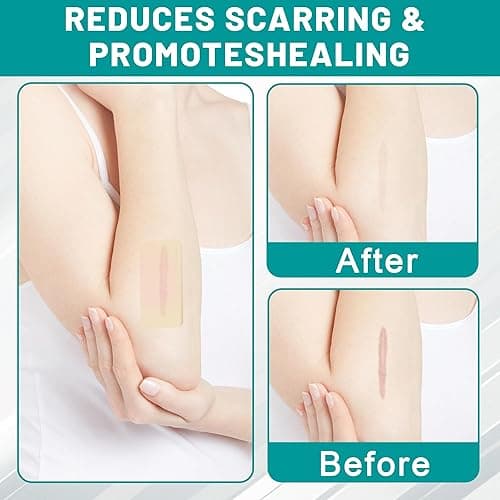 Hydrocolloid Roll, Hydrocolloid Bandages Roll for Wound Care, Medical Grade, Cut-to-Size, Self-Adhesive, Flexible & Waterproof, First Aid Kit Essential (2in x 6ft, 0.3mm Thickness) thumbnail 7