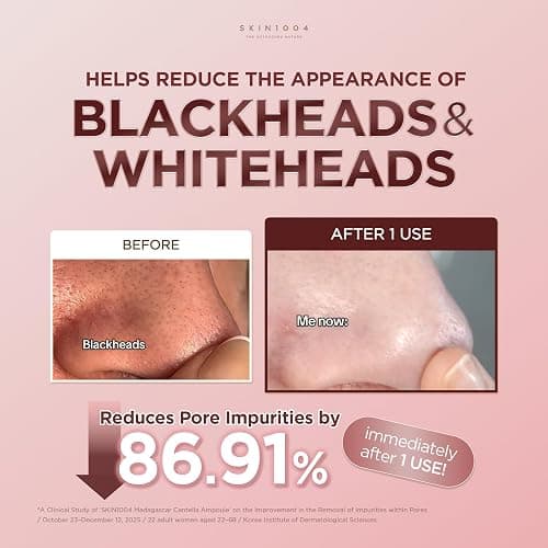 SKIN1004 Poremizing Quick Clay Stick Mask, Facial Clay Mask for Pores, Centella Clay Stick for Pore Minimizing, Pink Pore Mud Mask for Sebum Control, Korean Skin Care, 0.95 oz / 27g thumbnail 4