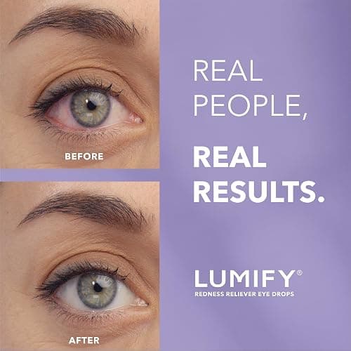 LUMIFY Eye Drops for Red Eyes, Redness Reliever for Brighter Looking Eyes, Works in 1 Minute & Lasts Up to 8 Hours, Eye Drops, 0.08 Fl Oz (2.5 mL) thumbnail 2