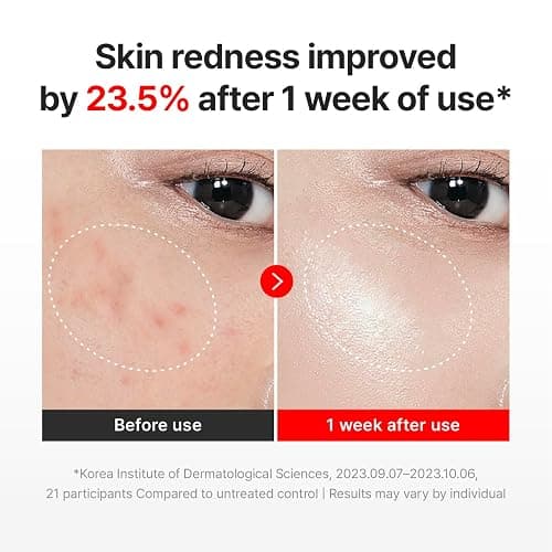 CENTELLIAN 24 Madeca Cream Time Reverse (1.69fl oz) - Advanced Fast-Absorbing & Nourishing, Hydrates, Firms & Reduces Wrinkles, Low Irritation, Korean Skin Care Centella Asiatica, Collagen thumbnail 3