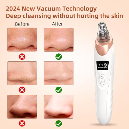 2025 Pore Vacuum, USB Rechargeable Blackhead Remover Vacuum,3 Levels Adjustable Pore Vacuum Blackhead Remover, with 5 Suction Power,6 Probes,Face Vacuum Pore Cleanser for Women & Men-White thumbnail 3