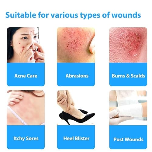 MIUXIA Hydrocolloid Roll Bandages Extra Large Pimp Patch Roll Self-Adhesive | 2in × 16ft Ultra Absorbent Flexible Latex Free Waterproof DIY Size thumbnail 6