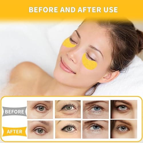 Qyiywim Under Eye Patches 70PCS, 24K Gold Eye Patches for Puffy Eyes Treatment, Under Eye Masks for Dark Circles and Puffiness, Non-Irritating Eye Mask Skincare, Eyes Bags Treatment, Eye Gel Pads thumbnail 7