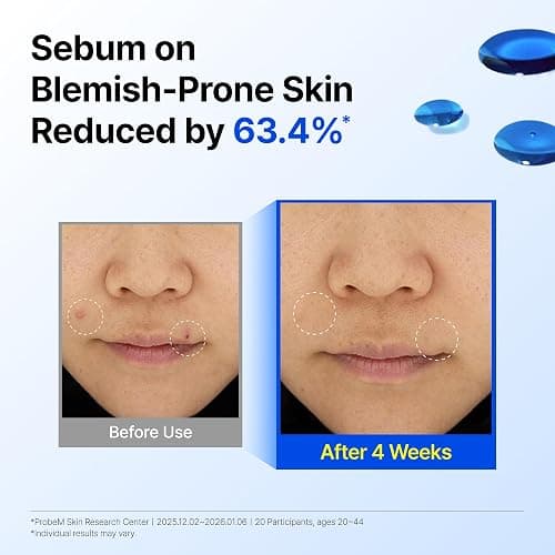 DearKlairs Korean EGF Serum – Blue Youth Activating Drop with EGF Peptides and Guaiazulene, Repairing Serum for Redness and Blemish-prone Skin, Visibly Fades Post-Blemish Marks, 0.33 Fl Oz thumbnail 5