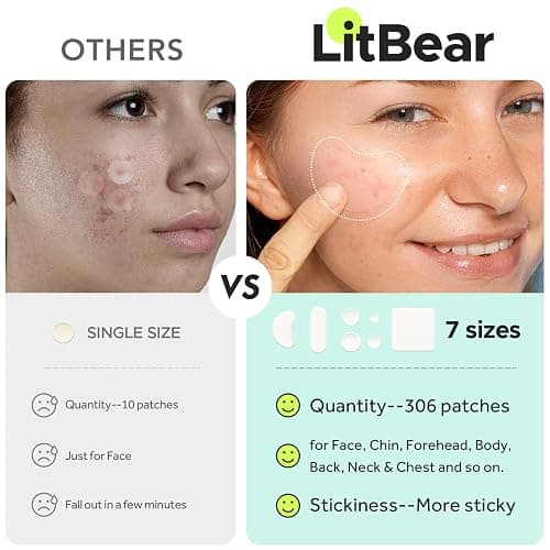 LitBear Large Pimple Patches (7 Sizes 306 Patches), Big Acne Patches, XL Hydrocolloid Bandages for Full Face, Forehead, Chin, Nose, Body, Back, Neck & Chest, Oval, Moon, Square hydrocolloid Patch thumbnail 7