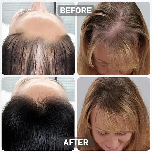 Hair Thickening Serum for Hair Loss, Korean Hair Growth Serum Roll On for Men and Women, Clinically Tested Rosemary Hair Growth Oil for Thinning Hair, Scalp Treatment, 0.5 Fl Oz thumbnail 7