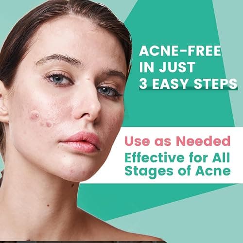 3-Step Microdart Pimple Patches Set – 83 Count, including 9 Microdarts Pimple Patches, 50 Pimple Poppers, and 24 Hydrocolloid Patches thumbnail 7